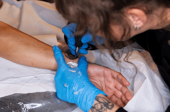 How Medical Tattooing Helps Hide Stretch Marks &Amp; Scars 2 Medical Tattooing
