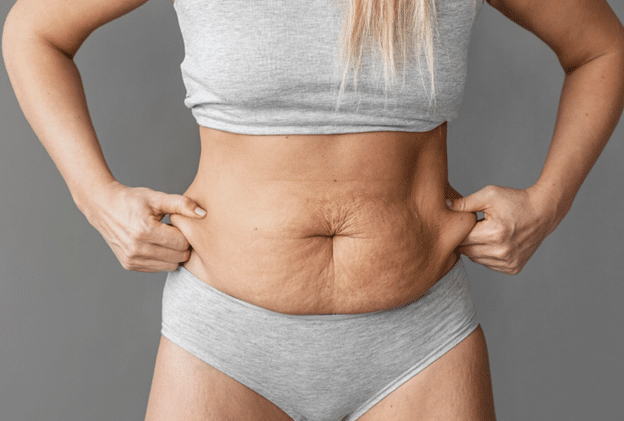 How Medical Tattooing Helps Hide Stretch Marks & Scars