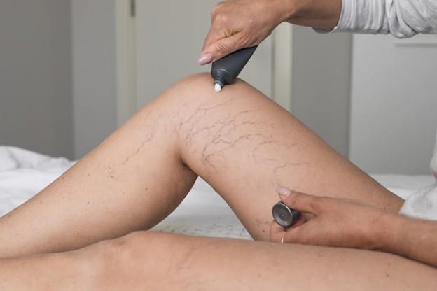 Stretch Mark Camouflage Treatment: Before & After Results Explained