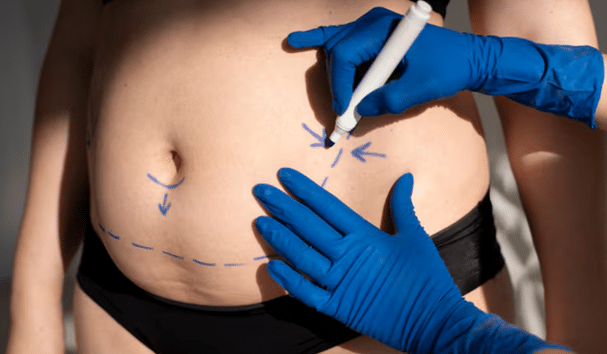 Scalp Micropigmentation vs. Hair Transplant: Which Is Right for You?